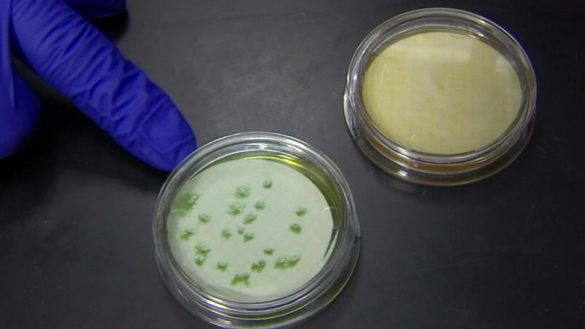 Pinellas County resident dies from Vibrio vulnificus: FDOH