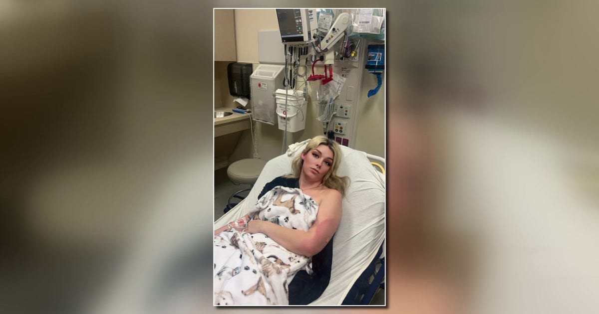 Lakeland woman details grueling dengue fever recovery as cases rise