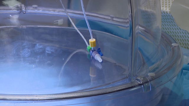 Tampa General lung transplants: New technology tests donor organ performance
