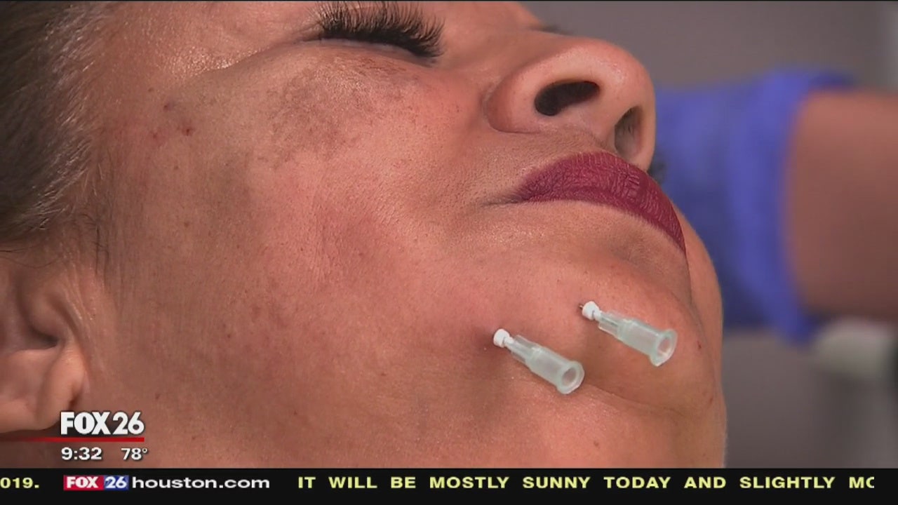 Face and body lifts for sagging skin using threads that dissolve FOX
