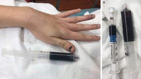 Rhode Island woman's blood turns black after using over-the-counter medication for toothache