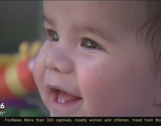 Woman Seeks Help On Facebook Fox 26 Aids In Securing Cranial Helmet For Baby