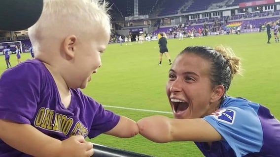 Adorable photo of boy without forearm bonding with Orlando soccer player goes viral