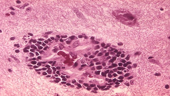 Feral cat in Harris County tests positive for rabies