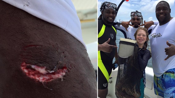 Warren Sapp bitten by shark while lobstering