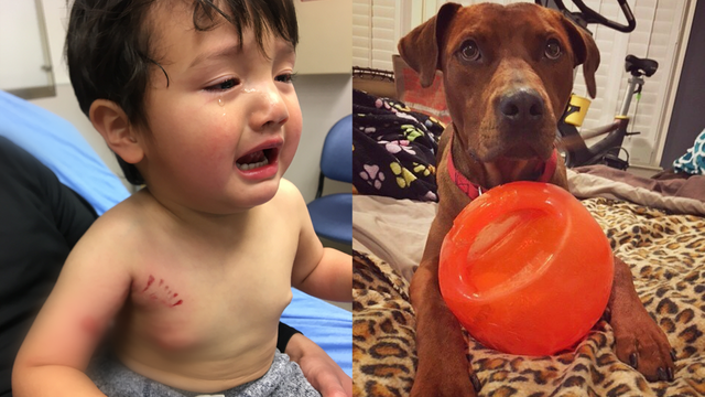 Dallas rescue group stands behind dog that bit toddler at adoption event