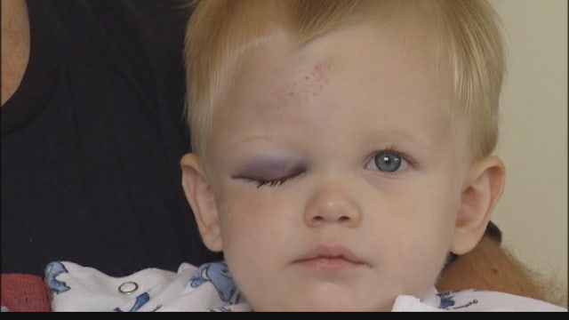2-year-old takes one to the face from home run ball