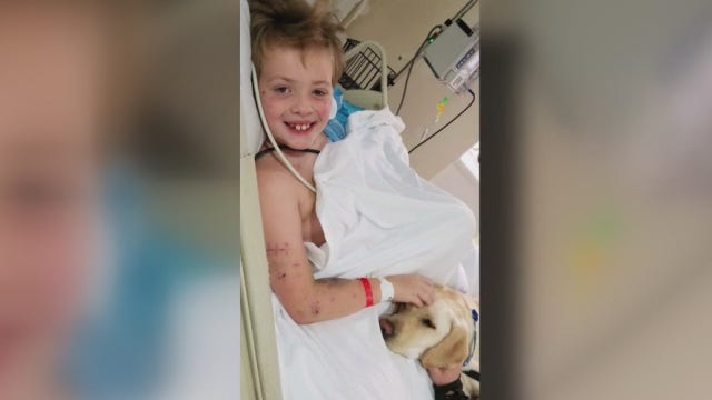9-year old boy undergoes several surgeries, spends weeks in hospital after being attacked by family dog