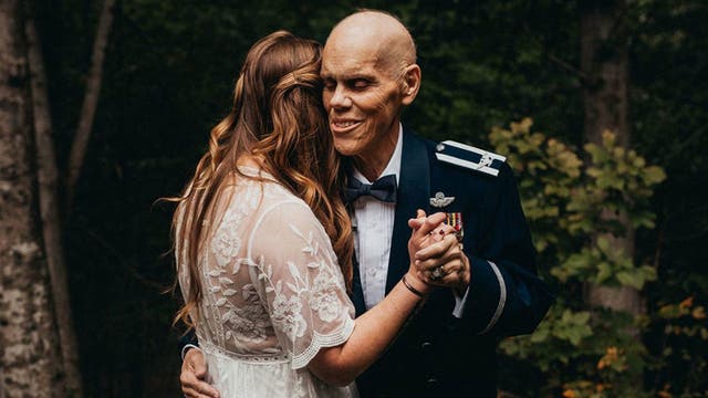 Bride-to-be nixes engagement shoot, takes photos with terminally-ill father instead