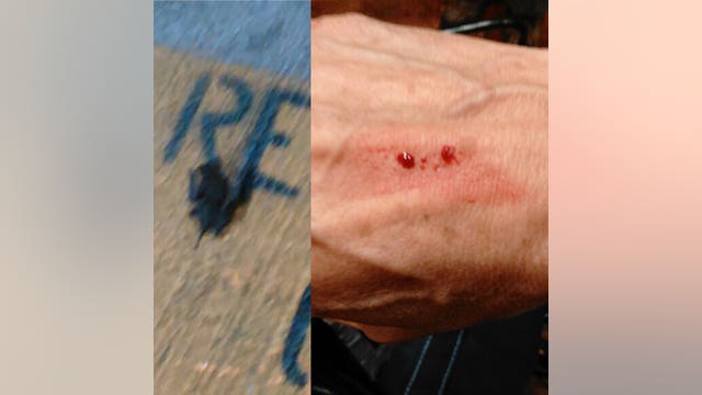 Rabid bat bites woman near downtown Houston