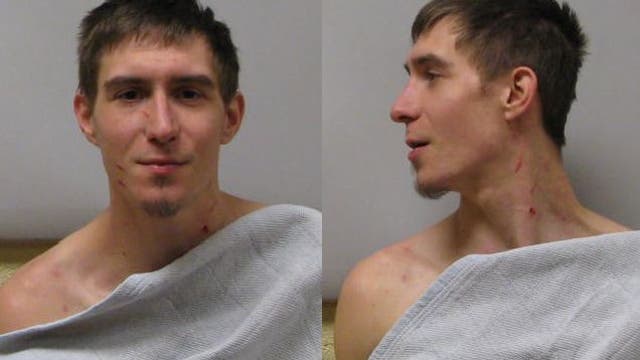 Dog stabbed 9 times gets new life with vet who saved her