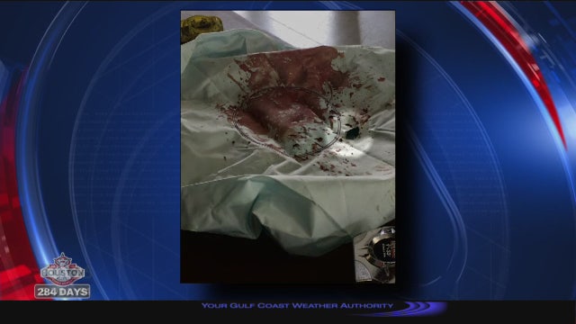 Fort Bend County family sues Honda, airbag maker after teen killed in minor crash