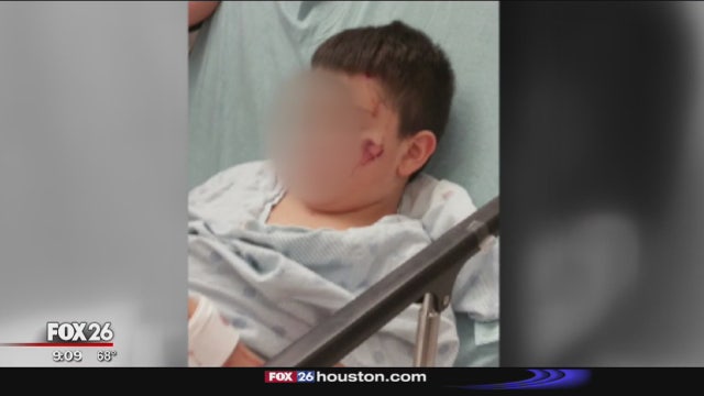 Mother, son hospitalized after road rage shooting