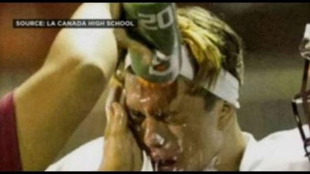 IcyHot smeared onto football player's face during game