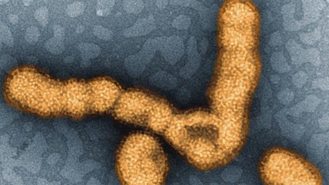 Baby boy suffers first flu-related infant death in Harris County this flu season