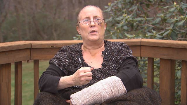 Maryland woman brutally attacked by bear: 'I really didn't think I was going to make it'