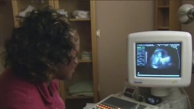 Black women 3 times more likely to die from birth complications than white women