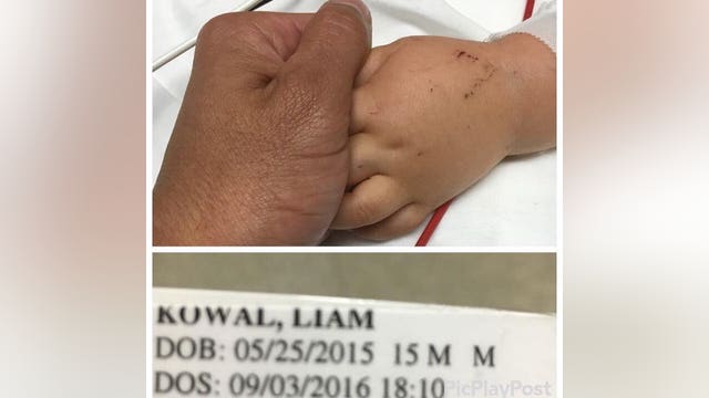 MMA fighter donates son's organs after baby killed by alleged drunk driver