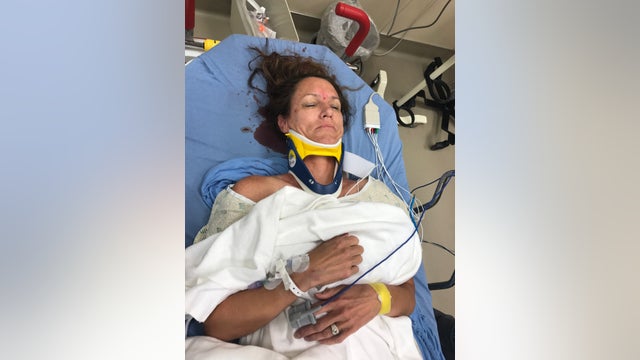 Cypress woman survives elk attack on vacation in Yellowstone