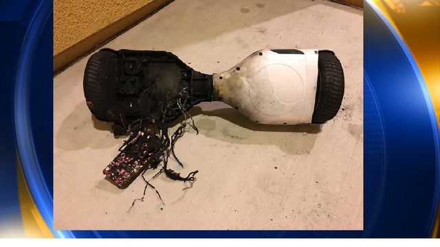 Brentwood teen's hoverboard catches fire, damages home