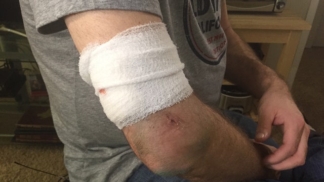 Man on hoverboard shoots Dallas driver, avoids capture