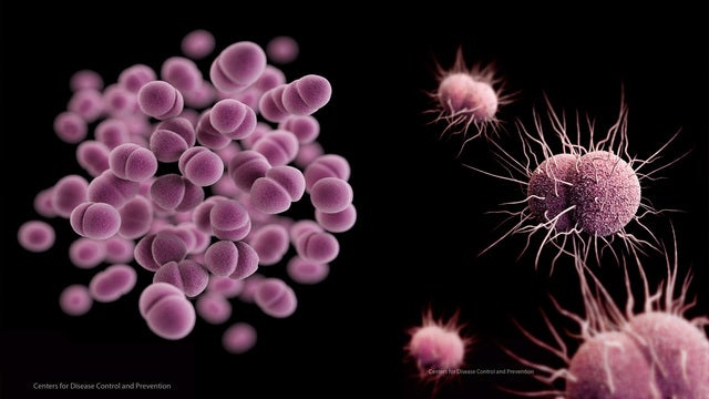 3 sexually transmitted diseases hit new highs again in US