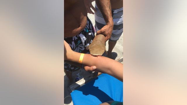 Shark attached to woman's arm on way to hospital