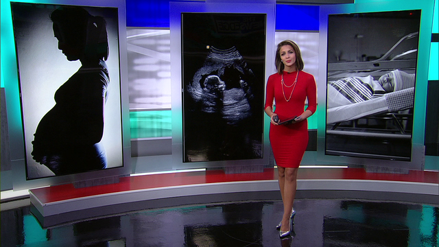 The Breakdown - childbirth death cases in Texas