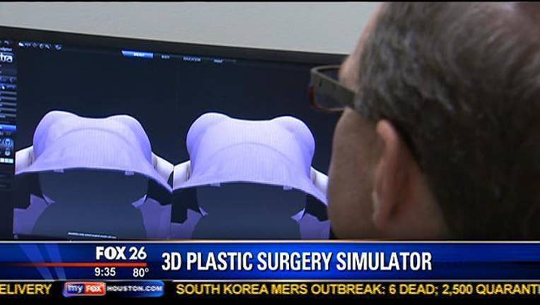 8b5f4319-3D Plastic Surgery Simulator