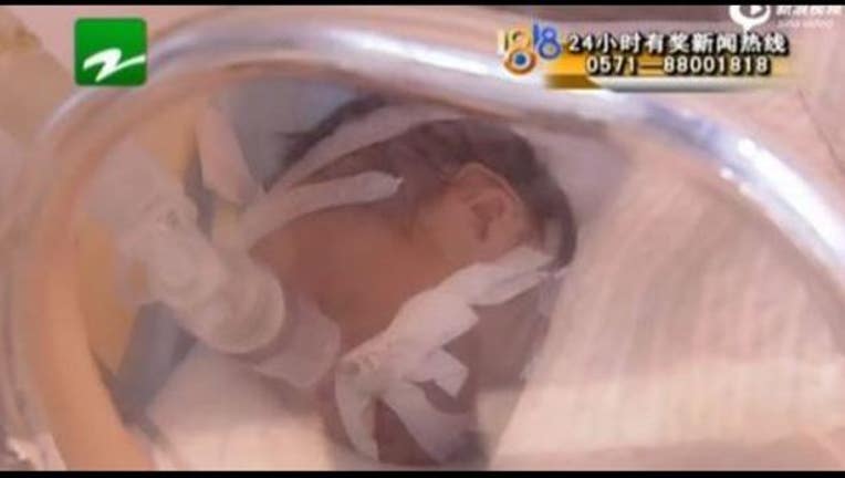 6dde9400-BABY_1455151801202.JPG