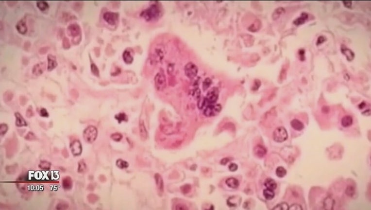 f4a5f453-DOH__Two_additional_measles_cases_report_0_20180816021040-401385