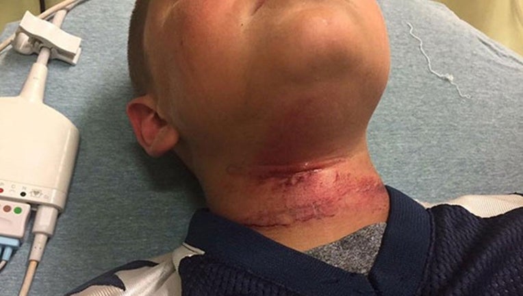 89198ea8-boy nearly hanged_1505332238481-404023.jpg