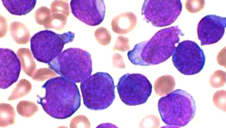 c0d250ec-cancer_1455651889832-401385.jpg