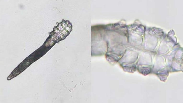 bc7970a0-demodex-mites_1558539290813-404023.jpg