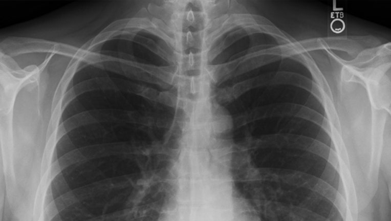 028a126a-x-ray_1450284254316-407693.jpg