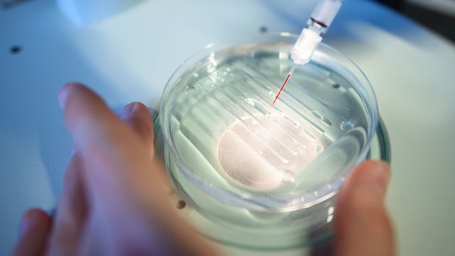 Doctors try CRISPR gene editing for cancer, a 1st in the United States