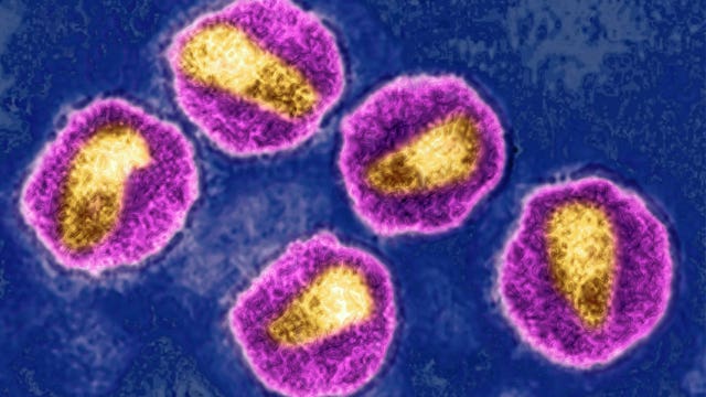 New strain of HIV detected for the first time in 19 years