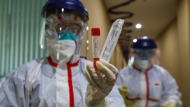 China's virus death toll surpasses SARS but new cases fall