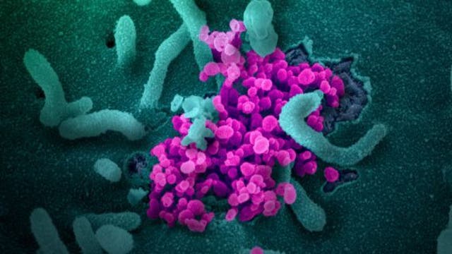 COVID-19 cases, hospitalizations continue surging in Harris County and Texas