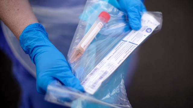 Houston, Harris County working to open COVID-19 testing sites