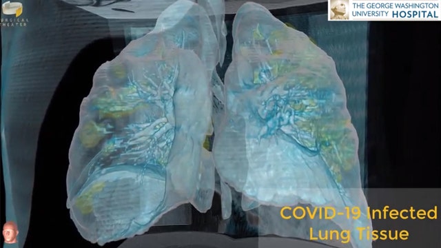 ‘It is affecting every age group’: 3D video shows extensive damage to lungs caused by COVID-19