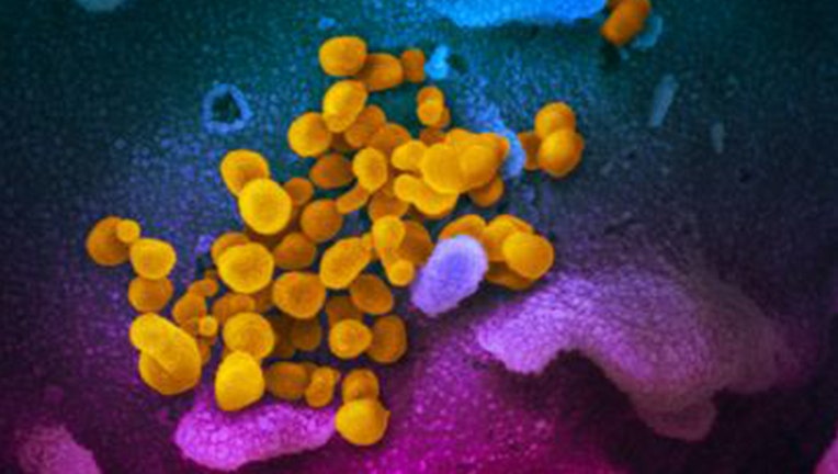 Yellow shapes coronavirus scanning electron microscope image