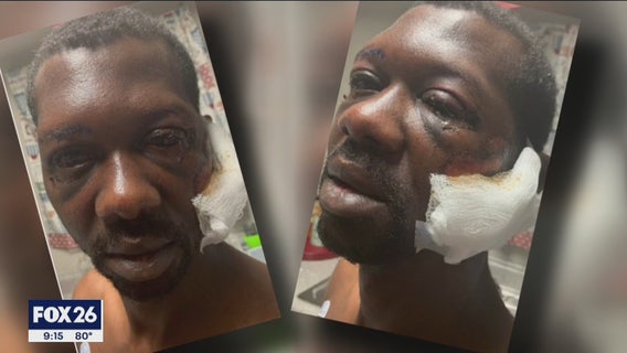 Lawsuit filed against Baytown police officers accused of beating and tasing Black man