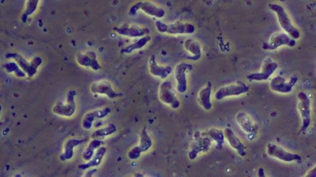 Rare brain-eating amoeba infection reported in Hillsborough County