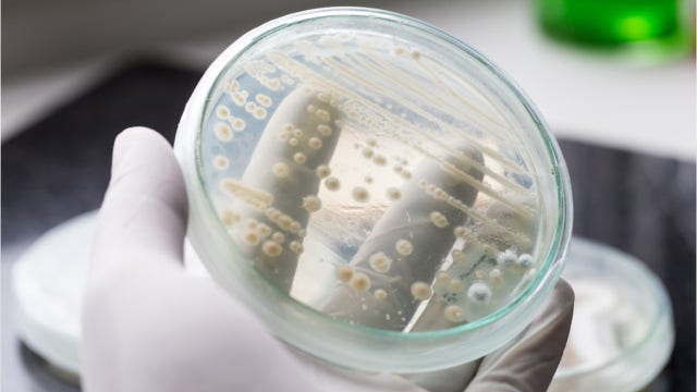 Researchers say they’re 1 step closer to delaying aging process, possibly extending human lifespan