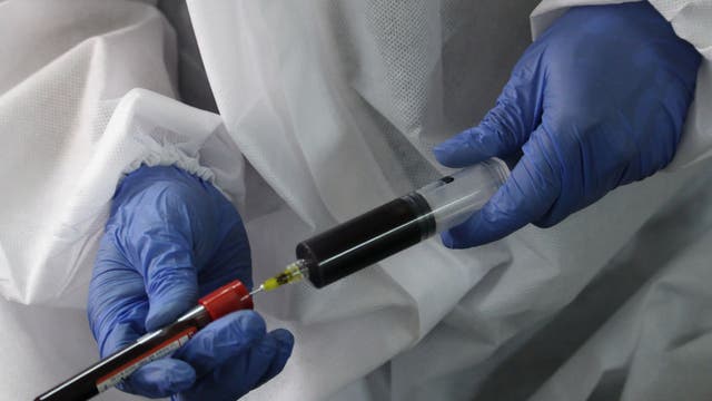 Red Cross asking recovered COVID-19 patients to donate plasma, citing shortage amid doubled demand