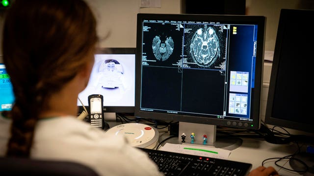 Scientists warn of potential brain damage linked to COVID-19