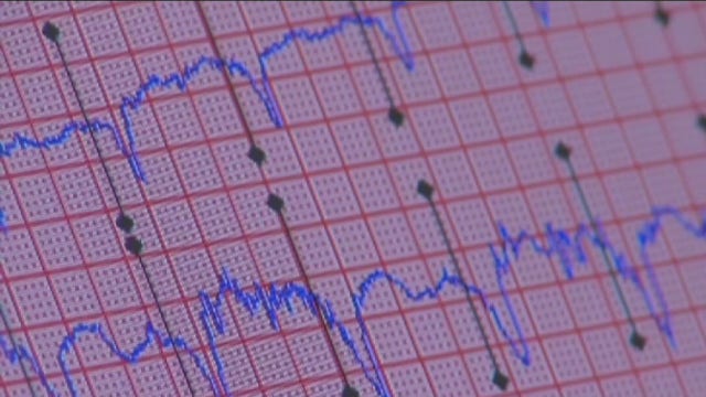 Study shows abnormal findings on cardiac MRIs in recovered COVID-19 patients