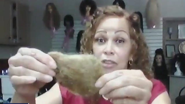 New study shows COVID-19 survivors losing their hair