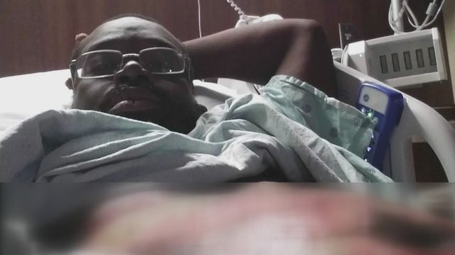 Man claims two METRO officers’ actions left him with severe burns